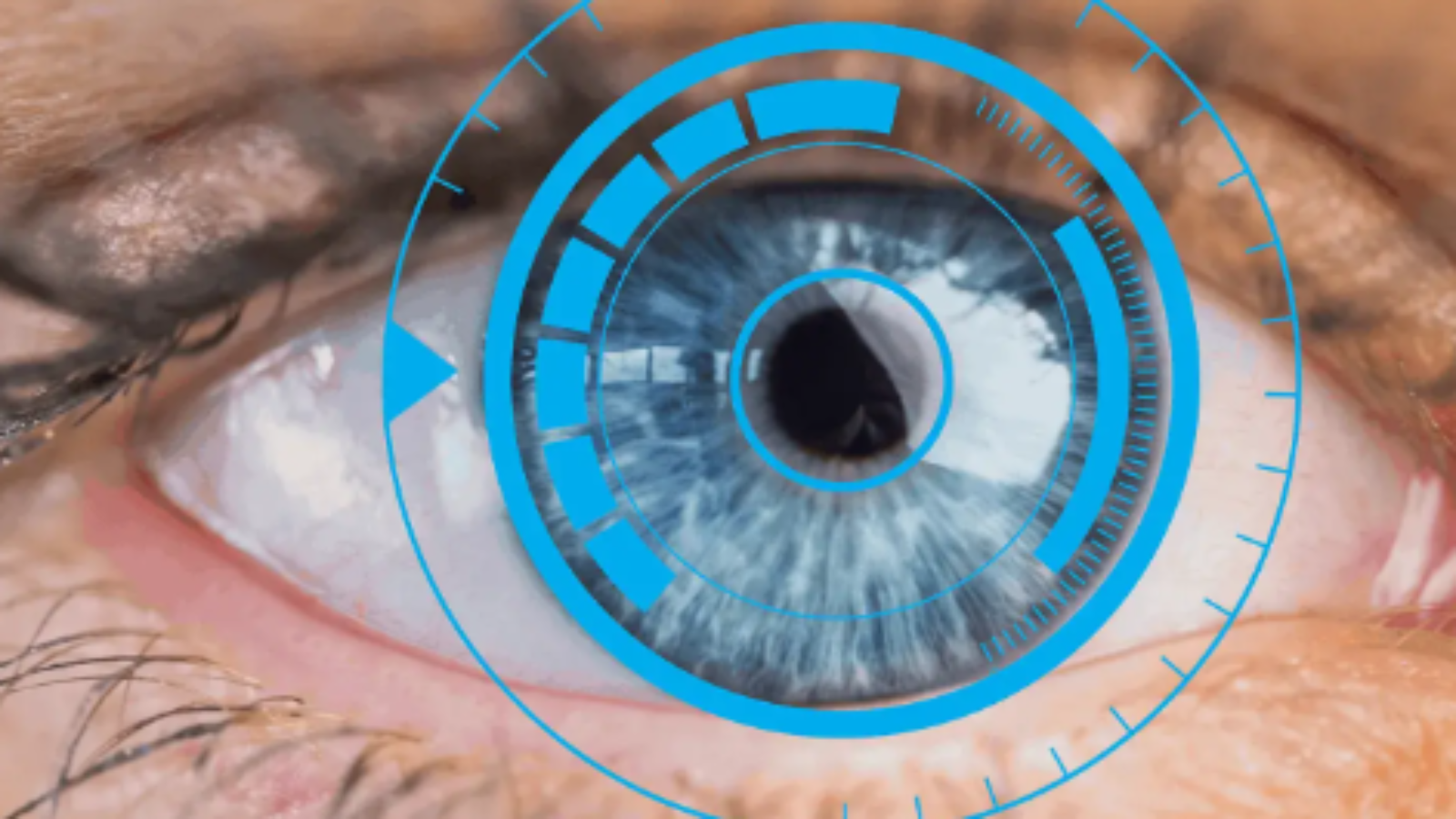 retina